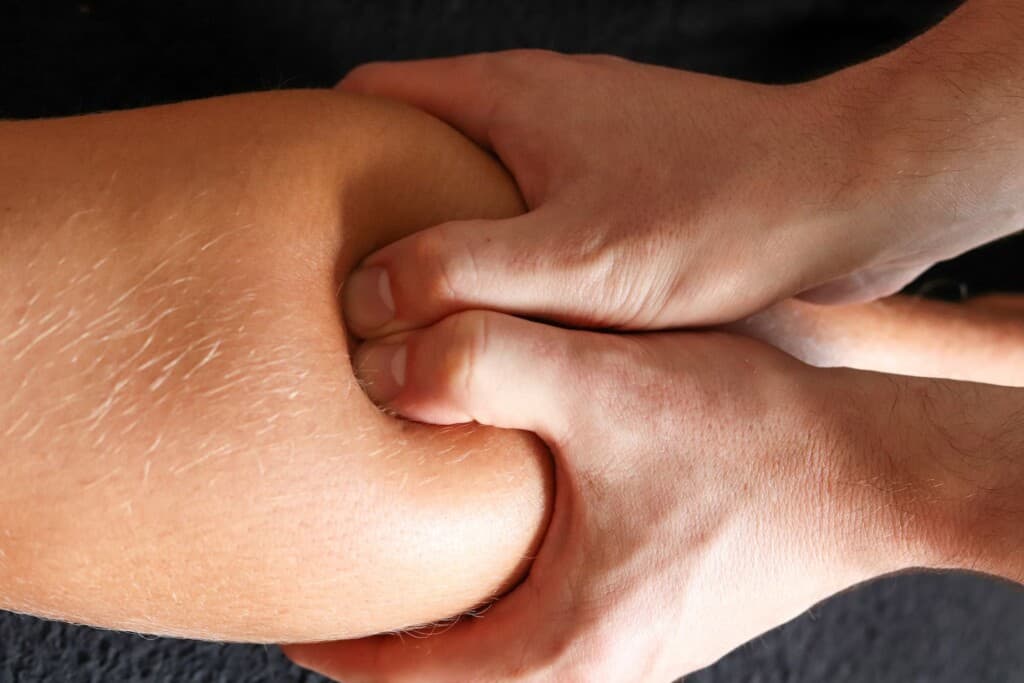 A close-up image of a knee with a bodyworker using both thumbs to apply deep pressure, targeting myofascial trigger points in the knee of a male client to release tension.